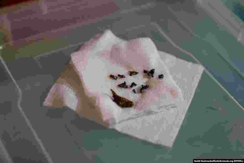 Fragments of shrapnel that were removed from the wounded at a medical facility near Avdiyivka in March 2024. 