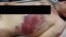 Следы пыток на теле Фарруха Урозова, таджикского мигранта, убитого полицейскими в России