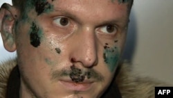 Adam Osmayev, one of the suspected militants accused of conspiring to kill Vladimir Putin, shortly after his detention in Odesa in early 2012.