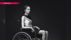 Как девушка с инвалидностью стала успешной фотомоделью (видео) Как девушка с инвалидностью стала успешной фотомоделью (видео)