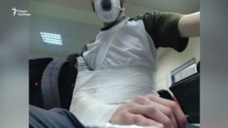 Полицейский сломал плечо журналисту на участке для голосования Полицейский сломал плечо журналисту на участке для голосования