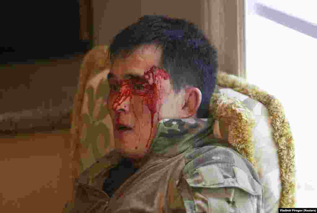 A bloodied member of the Kyrgyz special forces who was injured in the storming of the compound  