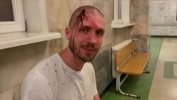 В Беларуси многотысячные протесты и столкновения В Беларуси многотысячные протесты и столкновения