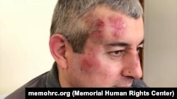 Сиражутдин Дациев после избиения