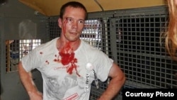 Ildar Dadin is serving 2 1/2 years for repeatedly holding unsanctioned demonstrations. This picture shows him in August 2014 after he was arrested by Moscow police during protests.