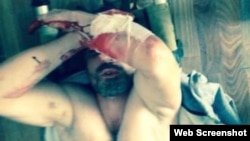 Житель дагестанского села Рутул Аким Кулиев порезал себя, не выдержав пыток