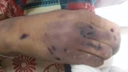 "د لُور بدن مې داسې شوی و لکه غلبېل" "د لُور بدن مې داسې شوی و لکه غلبېل"