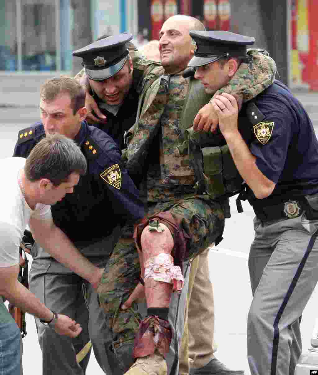 Полицейские оказывают помощь грузинскому солдату, раненому в бою с южноосетинскими сепаратистами в Гори. 8 августа 2008 года  