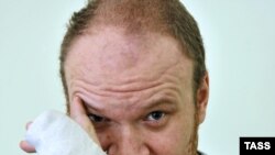 Kashin says he could have been beaten for his reporting on the Khimki forest or Pskov Oblast issues.